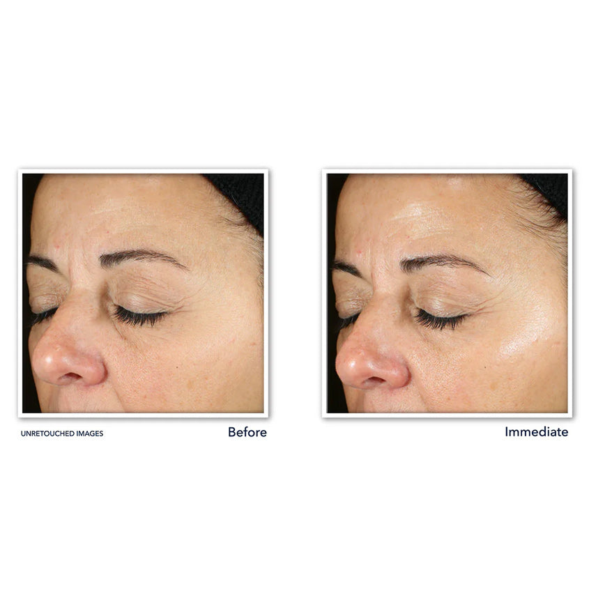 Multi Correxion® Revive + Glow Daily Serum