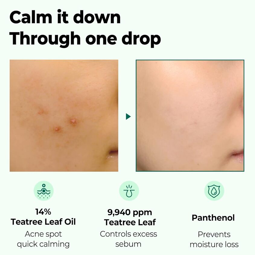 30 Days Miracle Tea Tree Clear Spot Oil