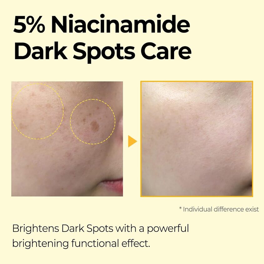 SOME BY MI YUJA NIACIN DARK SPOT CORRECTING STICK 10G – free delivery