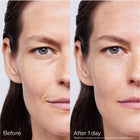 SHISEIDO SKIN FILLER 30x2ML – free delivery