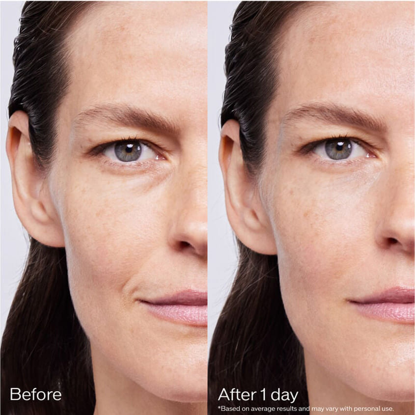 SHISEIDO SKIN FILLER 30x2ML – free delivery