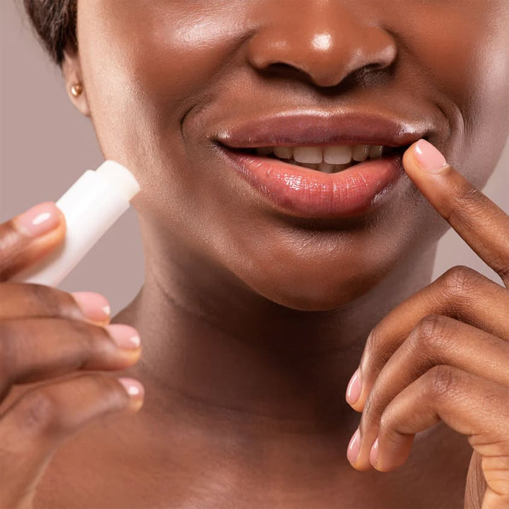SVR Topialyse Lip Balm