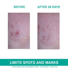 Hyseac 3-Regul+ Global Skincare SPF 30