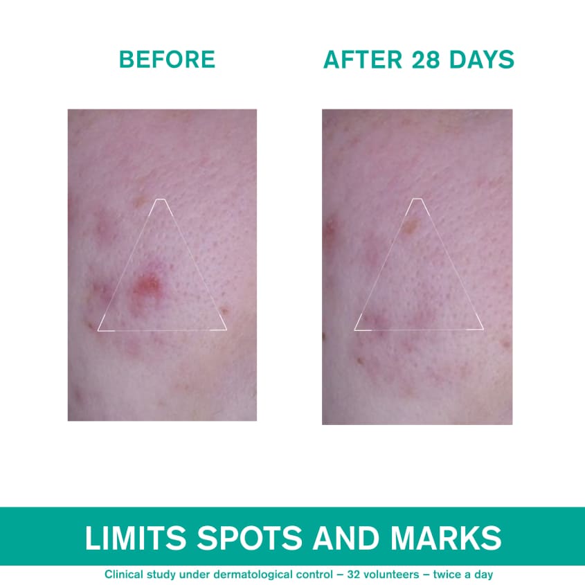 Hyseac 3-Regul+ Global Skincare SPF 30