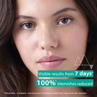 URIAGE Hyseac Anti-Blemsihes Serum