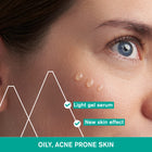 URIAGE Hyseac Anti-Blemsihes Serum