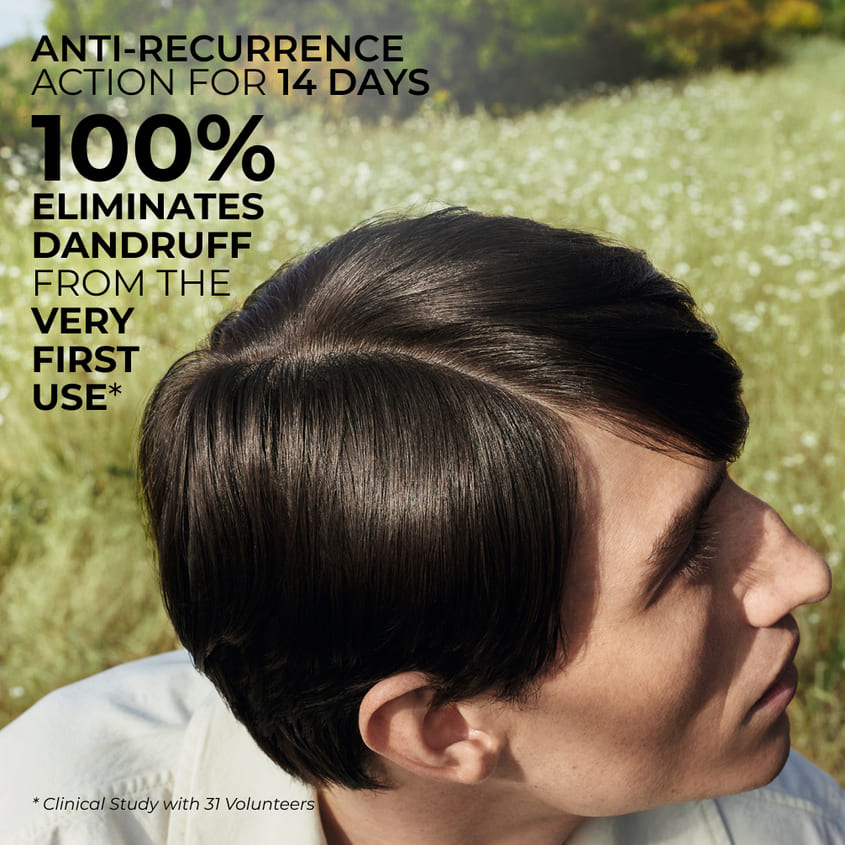 Anti-Dandruff Scalp Treatment Lotion